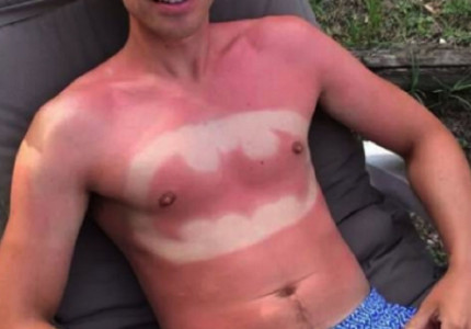 ‘Ouders onderschatten risico zon voor kinderen’