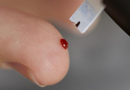 Zet de afstandsbediening van insulinepompen uit