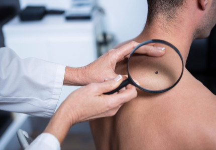 ‘We moeten meer smeren, vaker de huid checken en sneller naar de dokter’